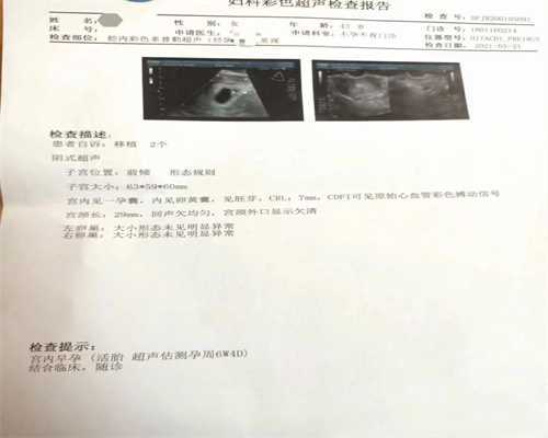 白带变得粘稠，能拉丝很长是不是排卵了？还在正准备排卵呢？