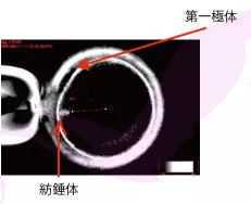 hiv患者去哪里做试管婴儿安全？需要打几针！